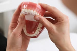 Invisalign Dr. Gütermann